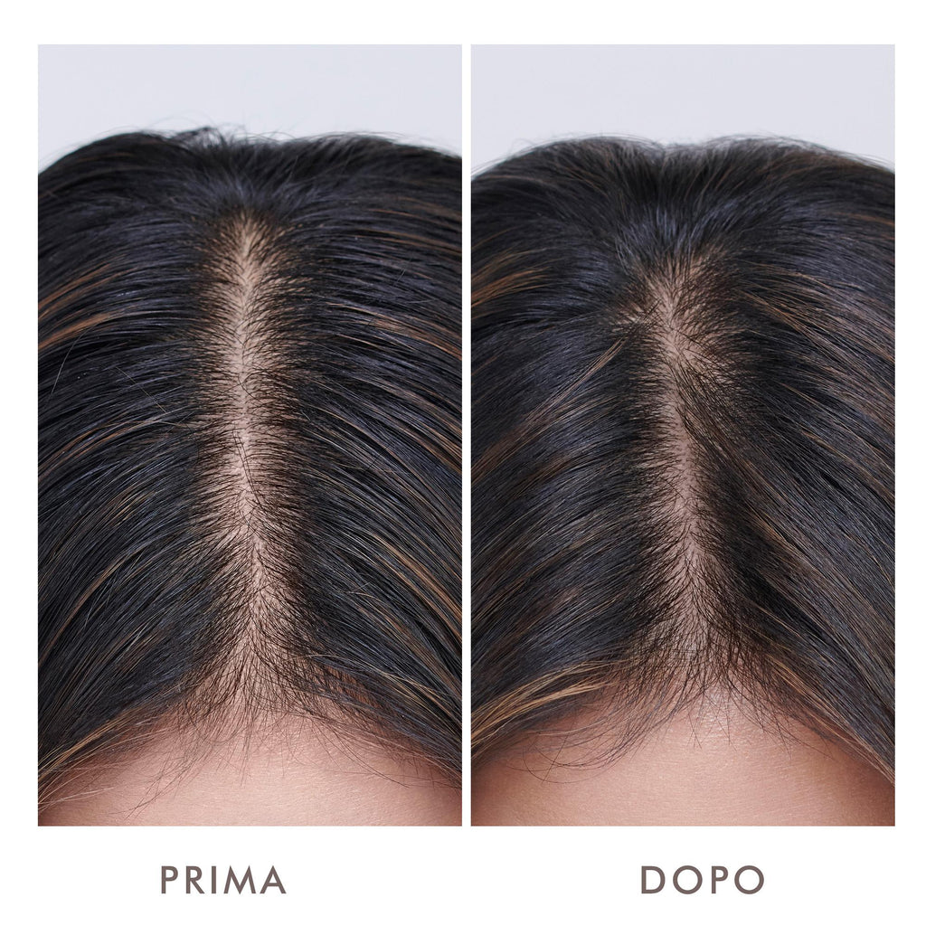 Oily Scalp Trearment