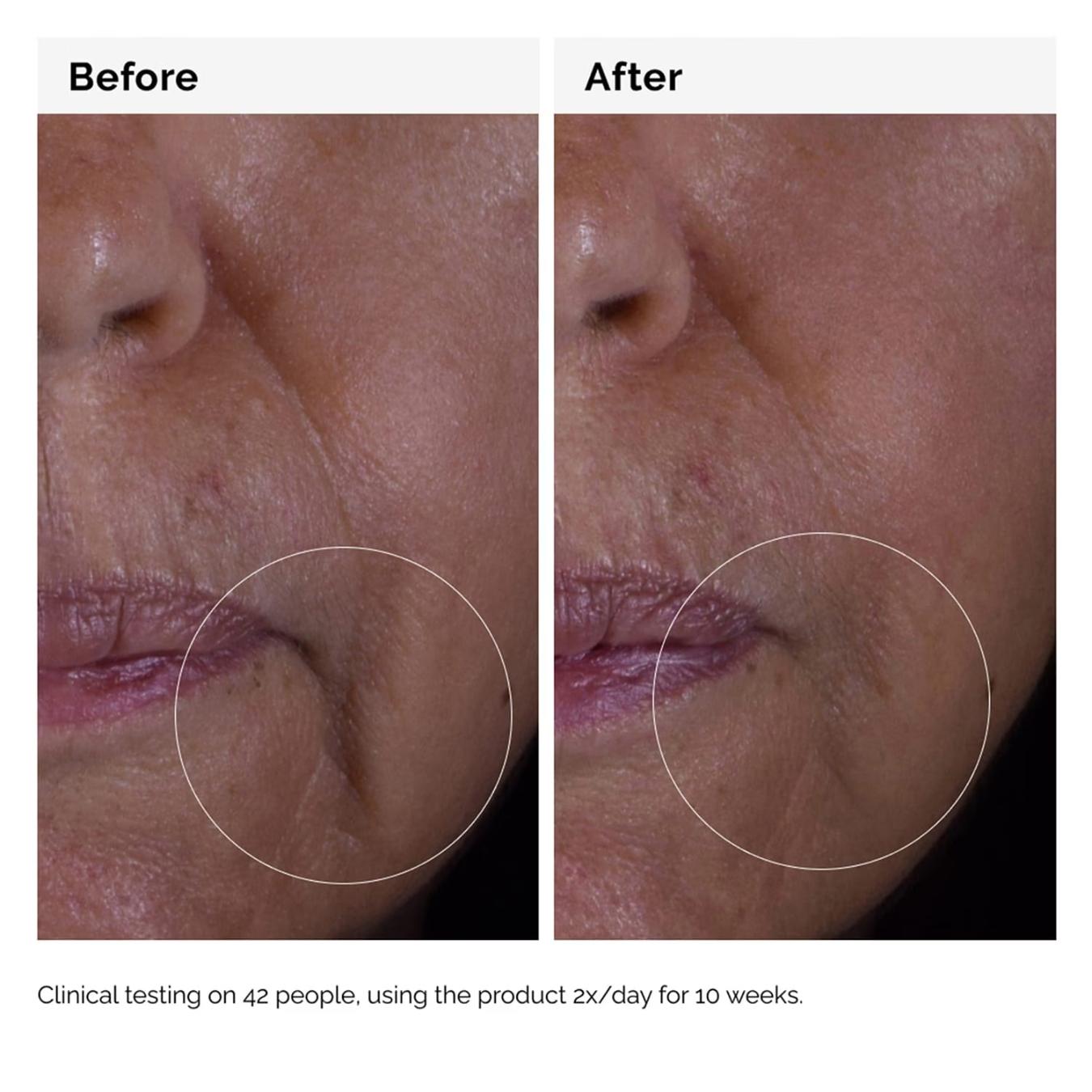 GF Solution 15% Serum